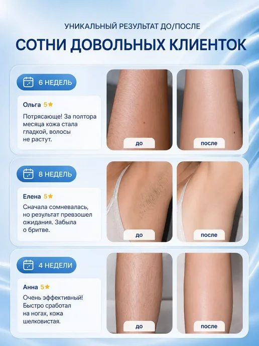 Фотоэпилятор лазерный профессиональный для удаления волос, белый, фото 7