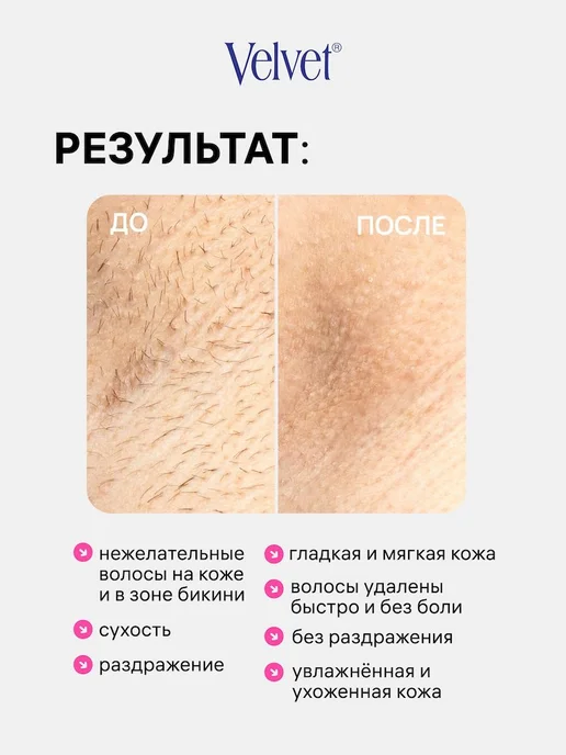 Кремдепилятор для чувствительной кожи бикини, мл, вариант, фото 3