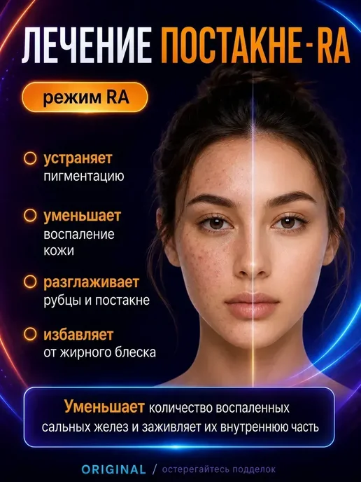 Фотоэпилятор профессиональный лазерный, розовый, фото 4