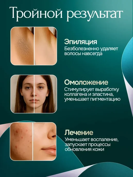 Фотоэпилятор профессиональный лазерный, розовый, фото 3