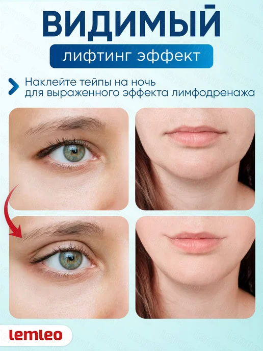 Тейпы для тела. Кинезио тейп, синий, фото 2
