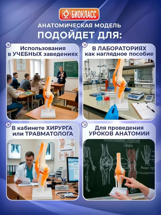 Модель коленного сустава человека на подставке, вариант, фото 2