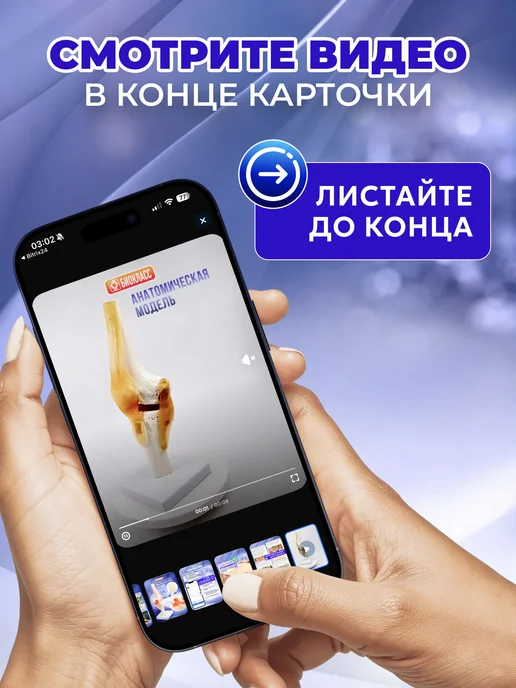 Модель коленного сустава человека на подставке, вариант, фото 4