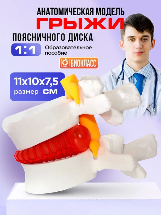 Анатомическая модель грыжи позвоночника учебный макет, вариант