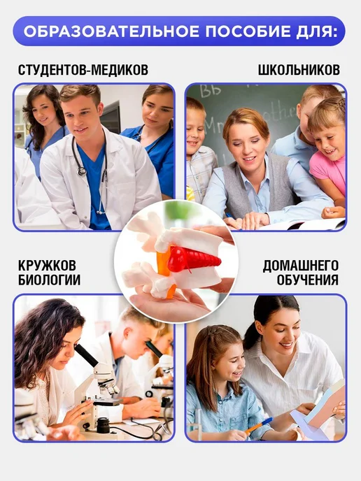Анатомическая модель грыжи позвоночника учебный макет, вариант, фото 4