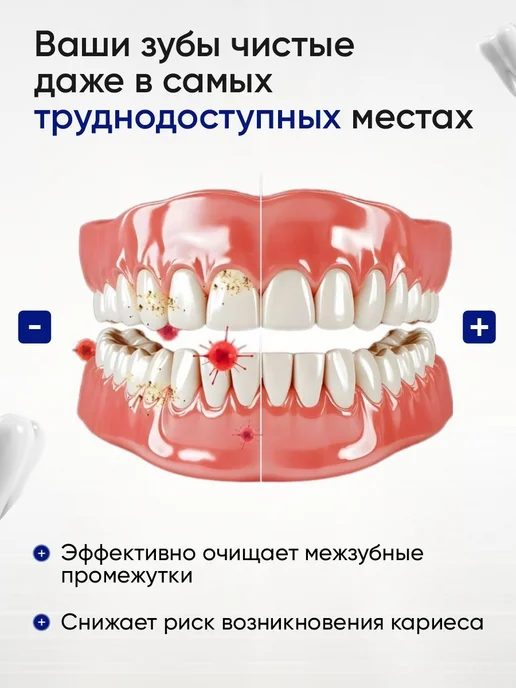 Нет бренда Межзубные ершики для брекетов и зубных 1-1 2мм 20шт, 20 шт, фото 6
