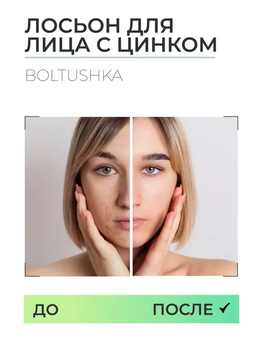 Лосьон Boltushka для лица и тела с цинком кожи, вариант, фото 3